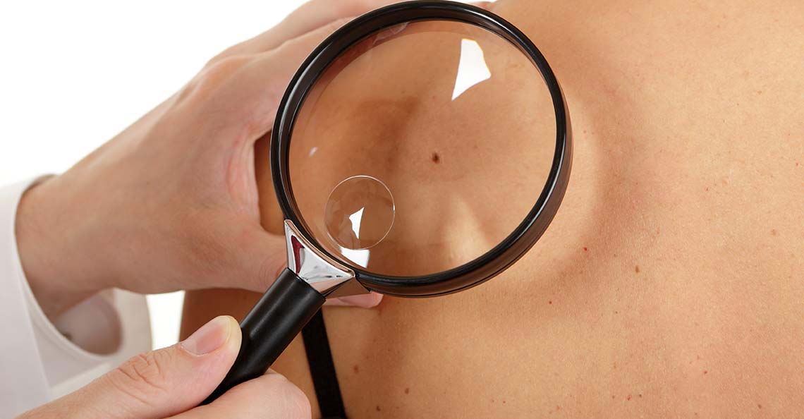 Skin Check by general practitioners at Wellness Medicine centre, Clifton Hill Doctors