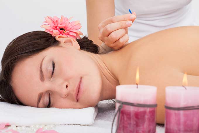 female with flower in hair receiving acupuncture therapy on her back from a registered acupuncturist in a candle lit room
